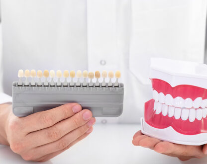 How to Decide if Dental Veneers are the Right Choice For You