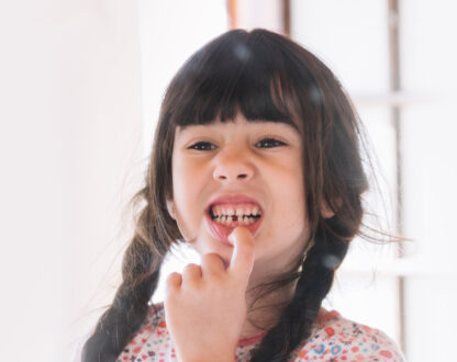 An-Overview-of-Dental-Bridges-to-Replace-Missing-Teeth