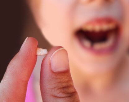 how-do-you-prepare-for-a-tooth-extraction