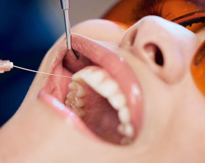Can Cavities Heal Naturally?